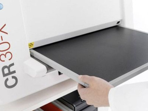 Agfa HealthCare DR MUSICA System for Northern Devon Healthcare NHS Trust