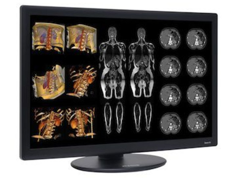 New Benchmark: Dome S6c LED Color Radiology Display Launched