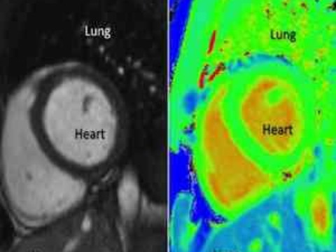 New, Safer, Faster Heart Scan Technique