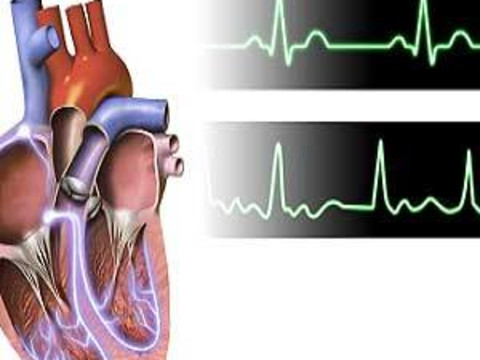 First Consensus Paper on Atrial Cardiomyopathies