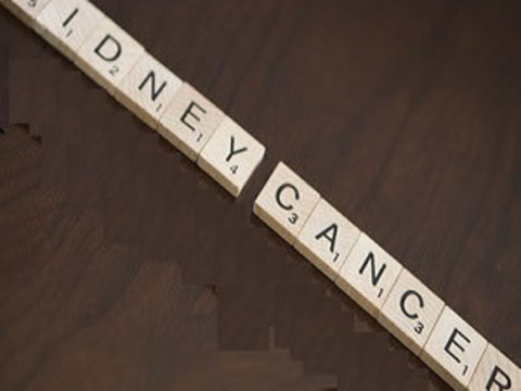 Sestamibi SPECT/CT Scan Improves Kidney Cancer Diagnosis