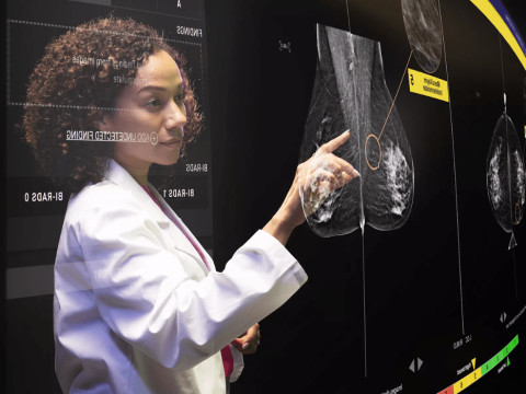 How AI is Revolutionizing Breast Cancer Detection and Saving More Lives
