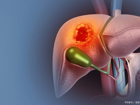 CT and MRI Signal HCC Subtypes for Individualised Care