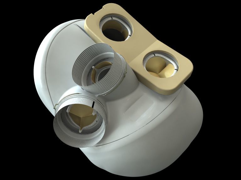 CARMAT Obtained Approval to Proceed with First Human Implantations of Its Total Artificial Heart CARMAT Obtained Approval to Proceed with First Human Implantations of Its Total Artificial Heart