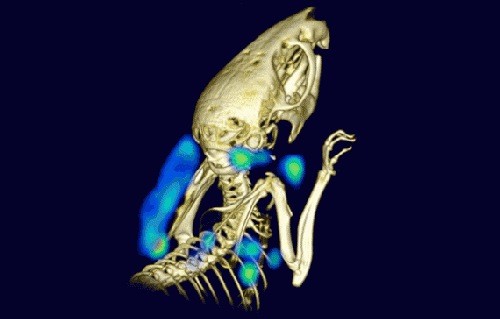 Noninvasive Imaging of Immune System Detects Tumours Noninvasive Imaging of Immune System Detects Tumours