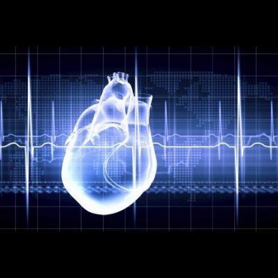 Near-Death Brain Signalling Speeds Cardiac Demise Near-Death Brain Signalling Speeds Cardiac Demise