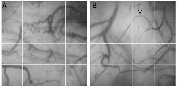 Study: Hyperoxia Alters Microcirculation in Healthy Volunteers Study: Hyperoxia Alters Microcirculation in Healthy Volunteers