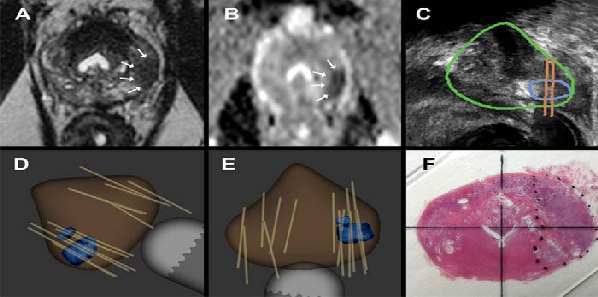 How 3D Printing is Reshaping Medical Practice How 3D Printing is Reshaping Medical Practice