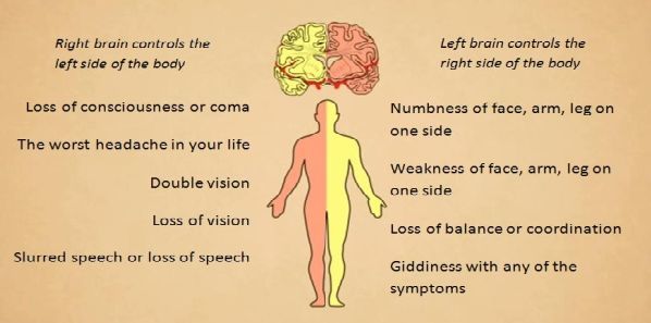 Coping with Pre-Hospital Stroke Symptoms Coping with Pre-Hospital Stroke Symptoms