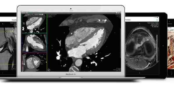 Calgary Scientific Extends Web and Mobile Image Access: Partnership with Hyland Calgary Scientific Extends Web and Mobile Image Access: Partnership with Hyland