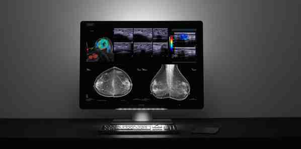 Barco Launches Breast Imaging and PACS Display Barco Launches Breast Imaging and PACS Display