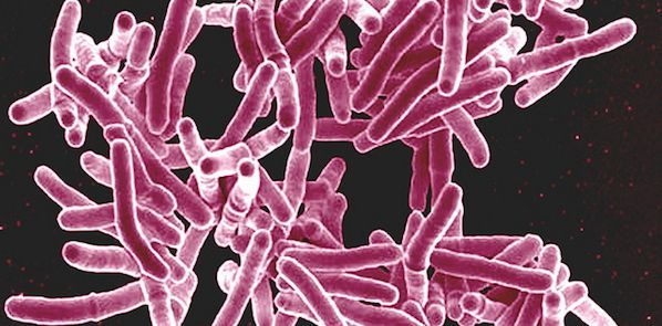 'Genetic Barcode' for Identifying TB Strains 'Genetic Barcode' for Identifying TB Strains