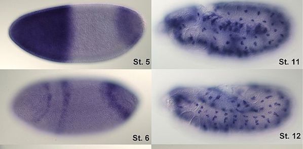 Radiogenomic Imaging Could Replace Biopsy Radiogenomic Imaging Could Replace Biopsy
