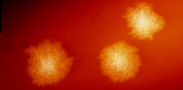 e-Nose Sniffs Out Superbug C. Diff e-Nose Sniffs Out Superbug C. Diff