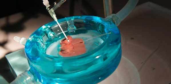 Transplant Organs Supercooled For Longer Storage Transplant Organs Supercooled For Longer Storage