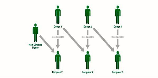 Kidney Transplant Chain Saves Six Lives In Australia Kidney Transplant Chain Saves Six Lives In Australia