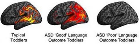 Brain Imaging Predicts Language Ability in ASD Toddlers Brain Imaging Predicts Language Ability in ASD Toddlers