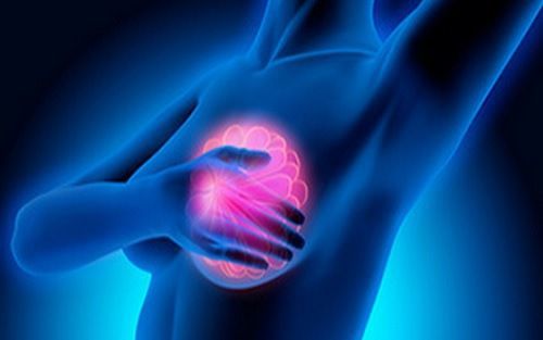 MRI Detects Breast Cancer with High Accuracy MRI Detects Breast Cancer with High Accuracy