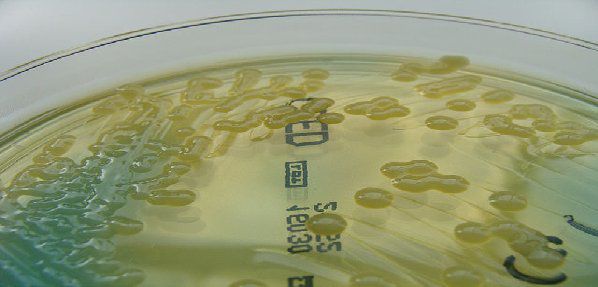 Cost of Nosocomial Infections in the ICU Cost of Nosocomial Infections in the ICU
