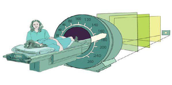 'Compressed Sensing': Reducing Radiation to One-Sixth 'Compressed Sensing': Reducing Radiation to One-Sixth