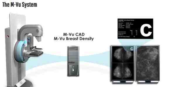 RSNA 2014: VuCOMP Showcases Industry-Leading Computer Vision Systems for Breast Cancer Detection RSNA 2014: VuCOMP Showcases Industry-Leading Computer Vision Systems for Breast Cancer Detection
