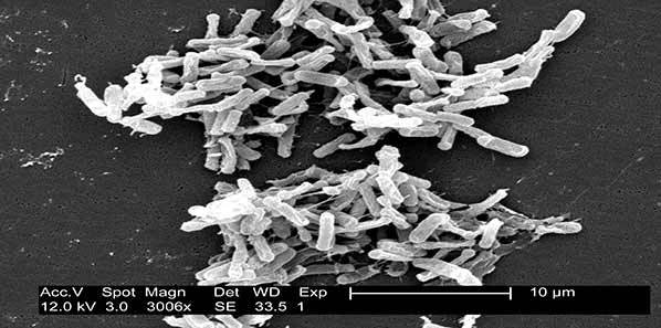 DNA Vaccine For C. Difficile DNA Vaccine For C. Difficile