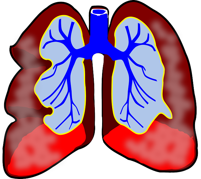 For Lung Transplant, Researchers Surprised to Learn Bigger Appears to Be Better For Lung Transplant, Researchers Surprised to Learn Bigger Appears to Be Better
