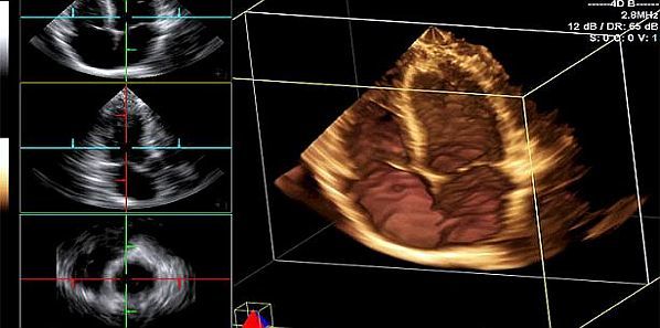 AHA to Clinicians: Know the Radiation Risks of Heart Imaging AHA to Clinicians: Know the Radiation Risks of Heart Imaging