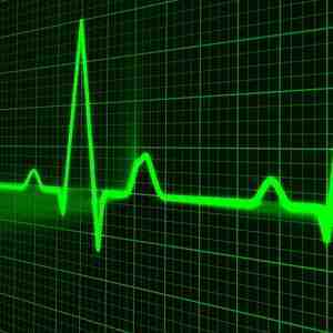 Therapeutic Hypothermia after Cardiac Arrest in Children Therapeutic Hypothermia after Cardiac Arrest in Children