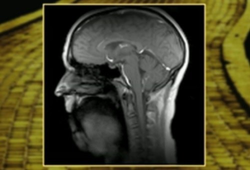 Superfast MRI Technique Superfast MRI Technique