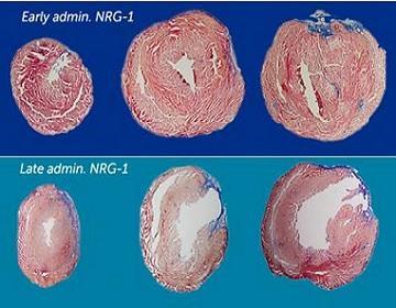 Heart muscle cells regenerate the fastest in the first six months of life Heart muscle cells regenerate the fastest in the first six months of life