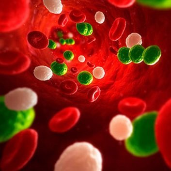 Sepsis: an infection of the bloodstream Sepsis: an infection of the bloodstream