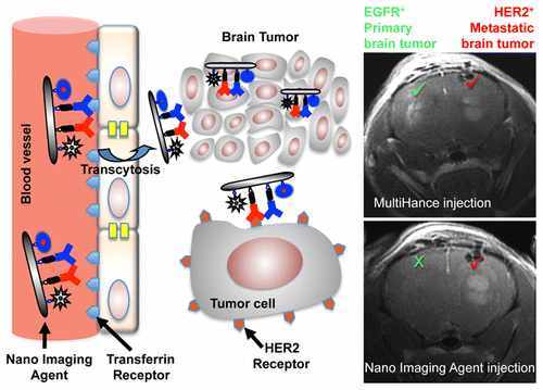 Noninvasive MRI diagnostic method Noninvasive MRI diagnostic method