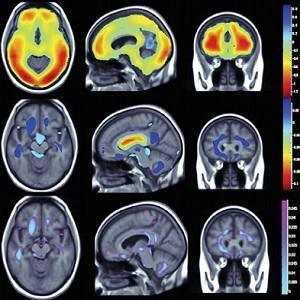 Obesity/physical activity and brain structure Obesity/physical activity and brain structure