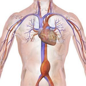 Drawing of an abdominal aortic aneurysm Drawing of an abdominal aortic aneurysm