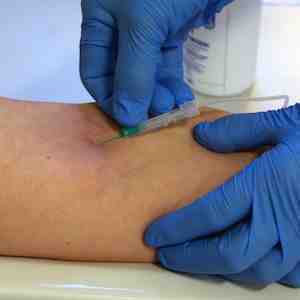 Patient's arm with blood being taken Patient's arm with blood being taken
