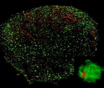 3D visualisation of Aβ plaques in AD model mouse 3D visualisation of Aβ plaques in AD model mouse