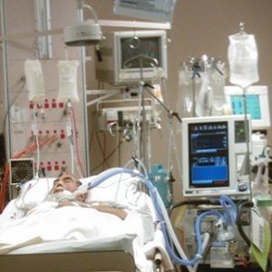monitoring equipment surrounds a patient in the ICU monitoring equipment surrounds a patient in the ICU