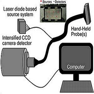 schematic of the handheld optical imaging system schematic of the handheld optical imaging system