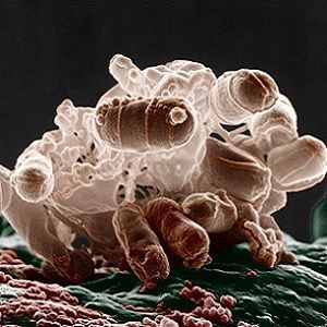 a micrograph of a cluster of E. coli bacteria a micrograph of a cluster of E. coli bacteria