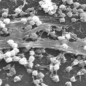 Fight Against Infections: Biofilms, MRSA, Funding Fight Against Infections: Biofilms, MRSA, Funding