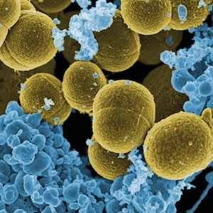 S. aureus under a microscope S. aureus under a microscope