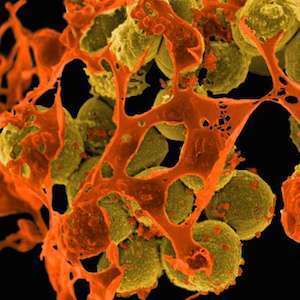 MRSA MRSA