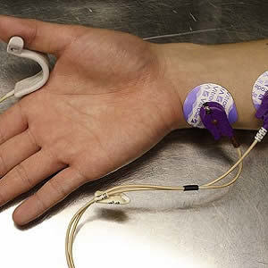 Neuromuscular Blockade in Management of Critical Illness Neuromuscular Blockade in Management of Critical Illness