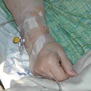 Vitamin C in Severe Sepsis Treatment Vitamin C in Severe Sepsis Treatment