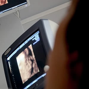 Hand-held Ultrasound for Abdominal Aortic Aneurysm Detection Hand-held Ultrasound for Abdominal Aortic Aneurysm Detection