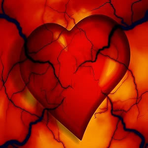 CT Angiography Better at Predicting Future Risk for Patients with Chest Pain CT Angiography Better at Predicting Future Risk for Patients with Chest Pain