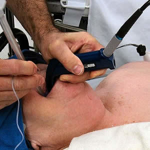 ICU Patients: Delayed Intubation Linked to Poor Outcome ICU Patients: Delayed Intubation Linked to Poor Outcome