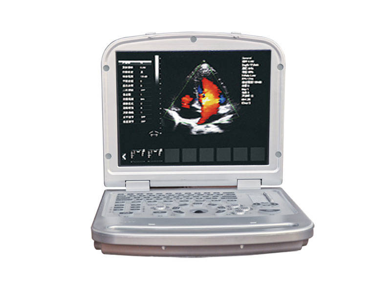 Laptop Color Doppler Ultrasound Scanner