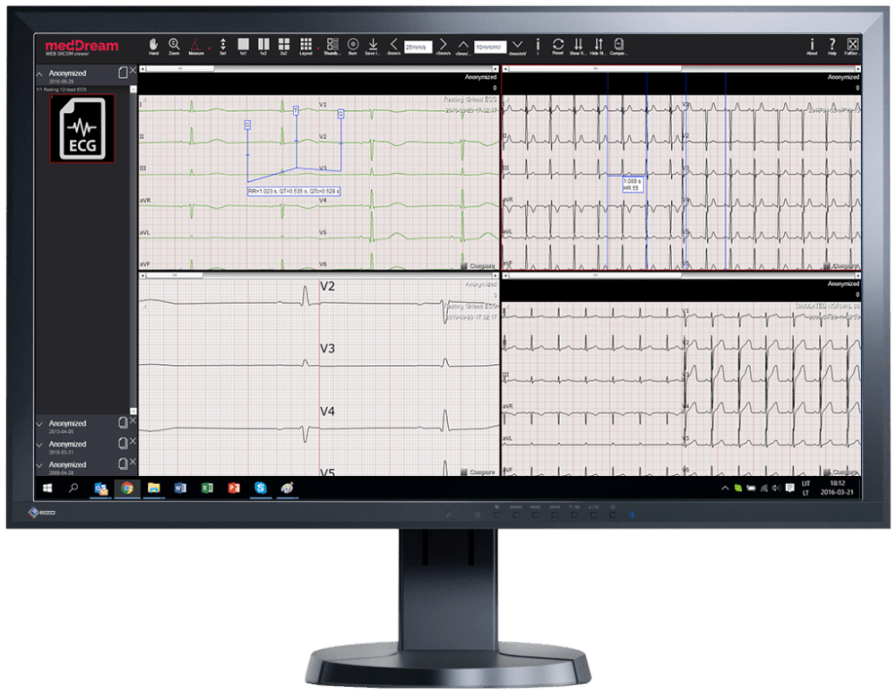 MedDream DICOM Viewer: Cardiology (ECG) module
